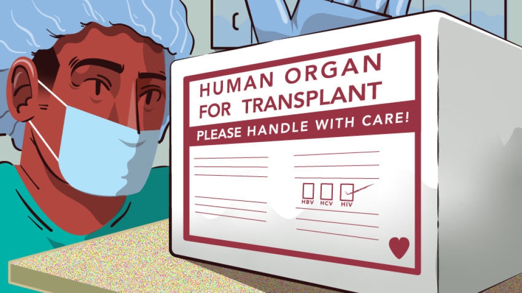 Organ chronic disease hiv tranplant donation