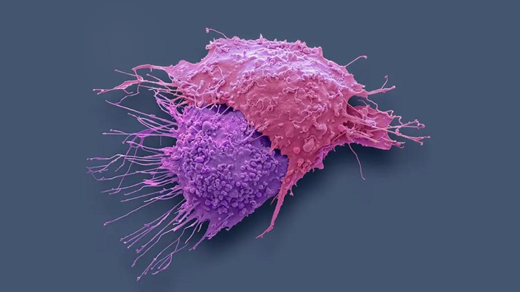 Ovarian Cancer Cells