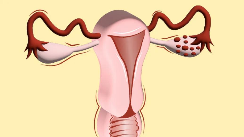 ovaries and fallopian pink red and yellow background