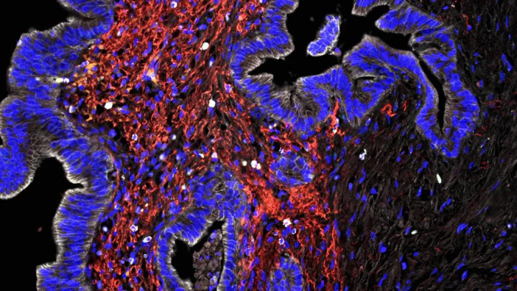 purple black red cell image close up