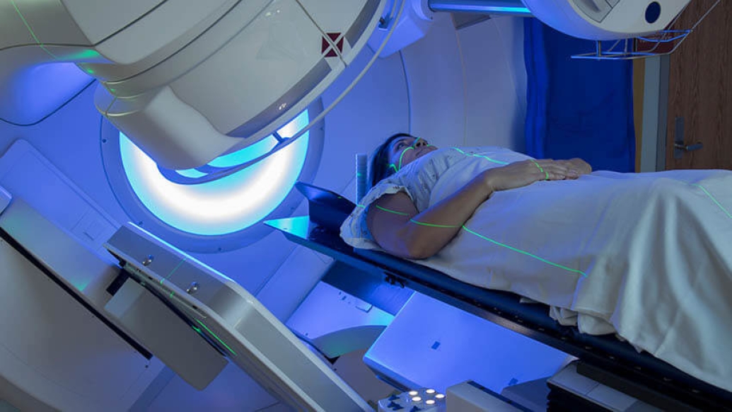 Radiation therapy of young women breast cancer