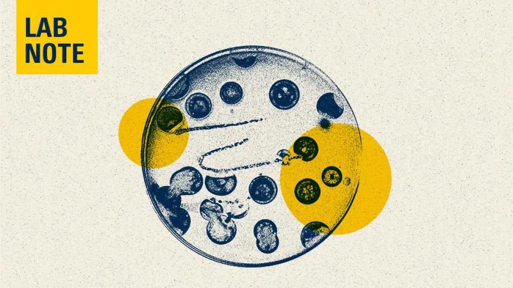 Bacteria in Petri dish