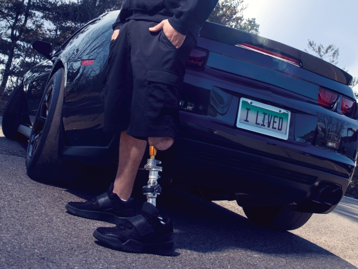 Michael Asher's prosthetic leg with a black car with the license plate "I Lived" in the background
