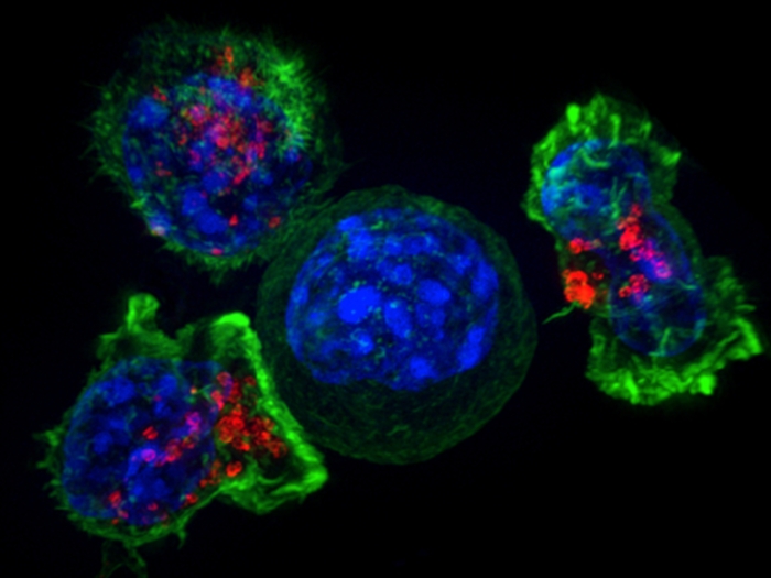 cancer cells microscope blue green
