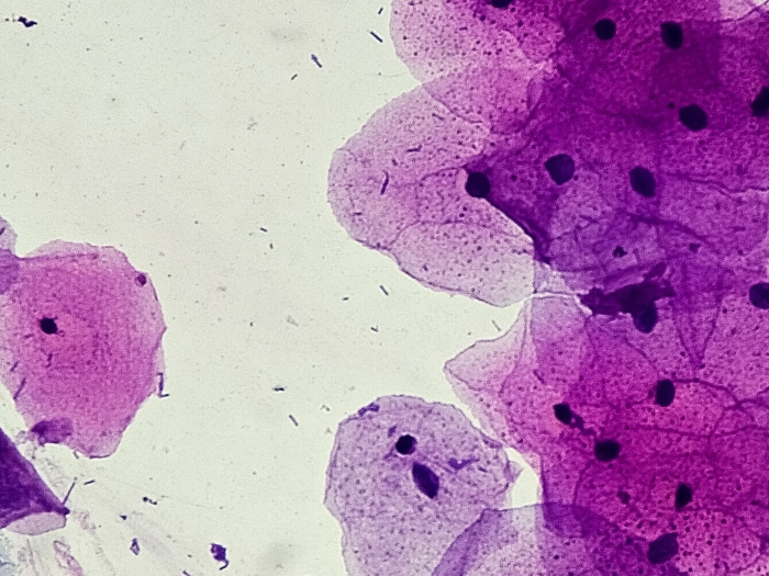purple cells under microscope