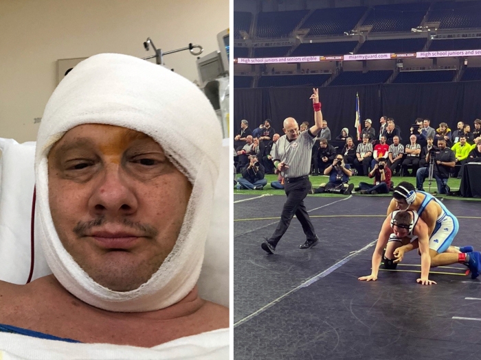 bandage on head and wrestling match ref