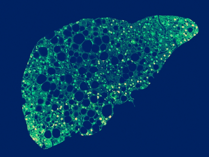 liver in bright green against navy background