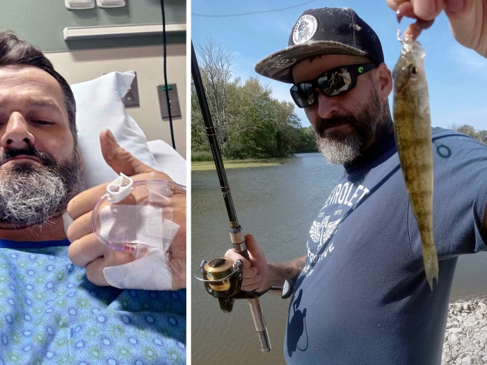 photo side by side with man in hospital bed and then holding fish in hand in other photo