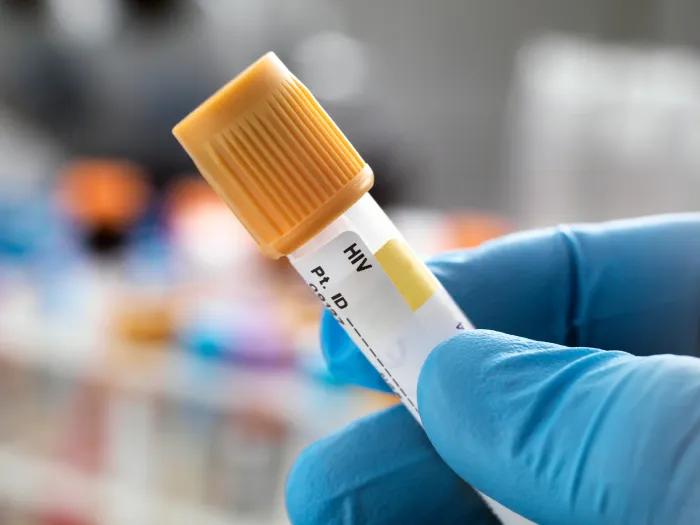 Medical gloved hand holding test tube sample for HIV testing.