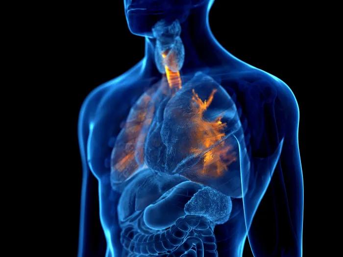 Computerized image of a human torso with lungs illuminated