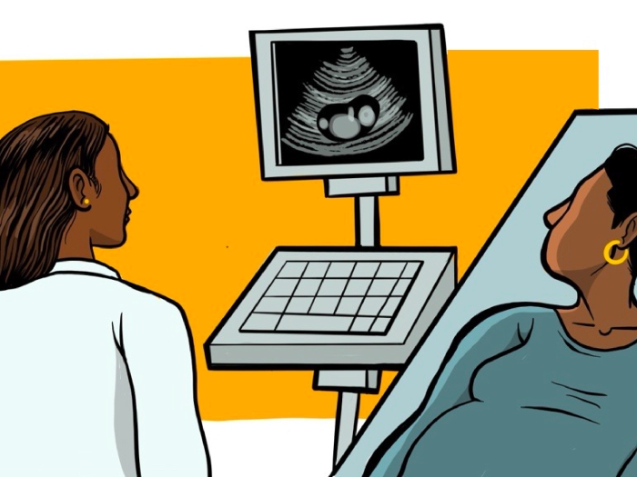 Illustration of a doctor and patient looking at ultrasound