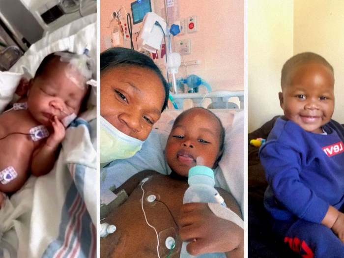 Dinero is back to being an active toddler following a kidney transplant