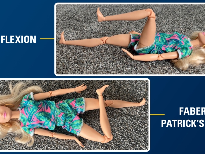 Barbie doll placed in stretching positions for a visual aid for doctors