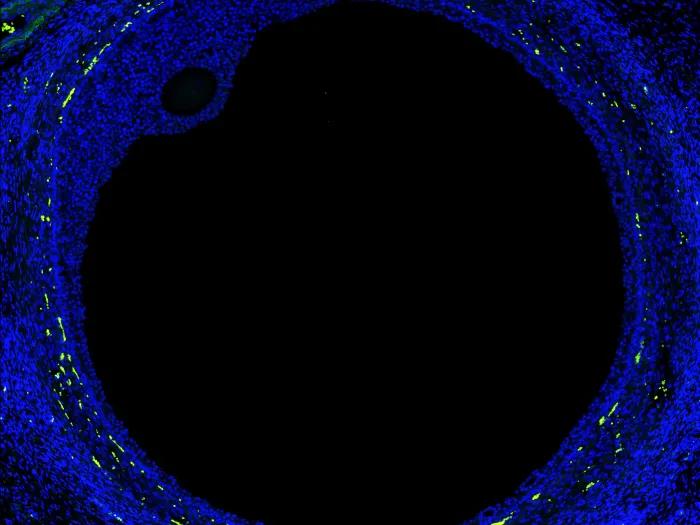 Florescent image of a human ovarian follicle