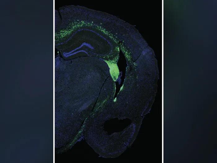 Xray of a stem cell in a mouse brain.