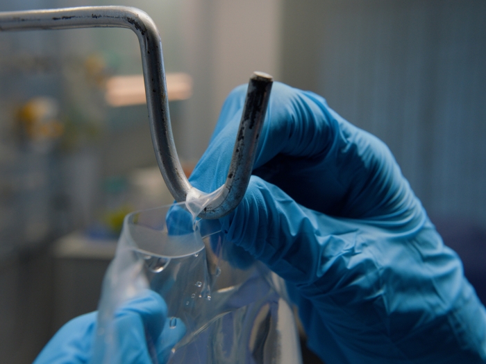 blue gloves in hospital hanging IV bag