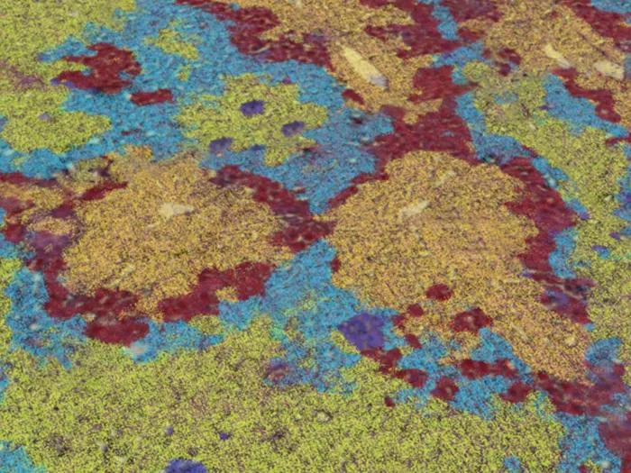 yellow blue maroon close up image of cells