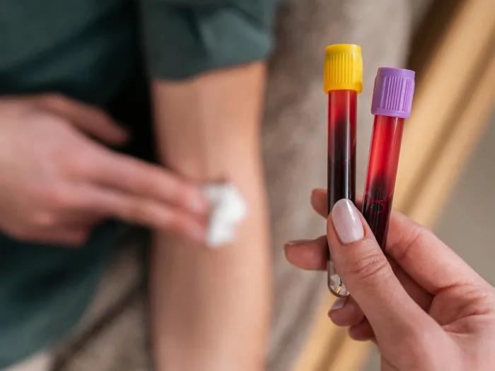 blood test bottles above arm with white bandaid