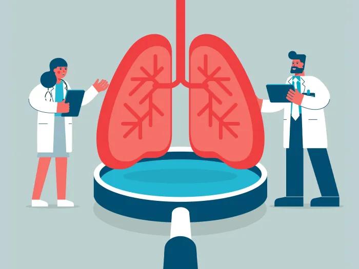 doctors drawn looking at big oversized lungs