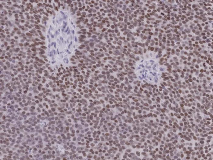 cells purple some lighter cells in white