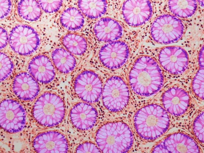 pink cells up close