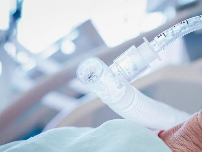 breathing tube in patient close up in hospital bed