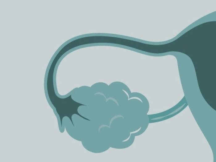 A stylized medical illustration of a fallopian tube and ovary (part of the female reproductive system).
