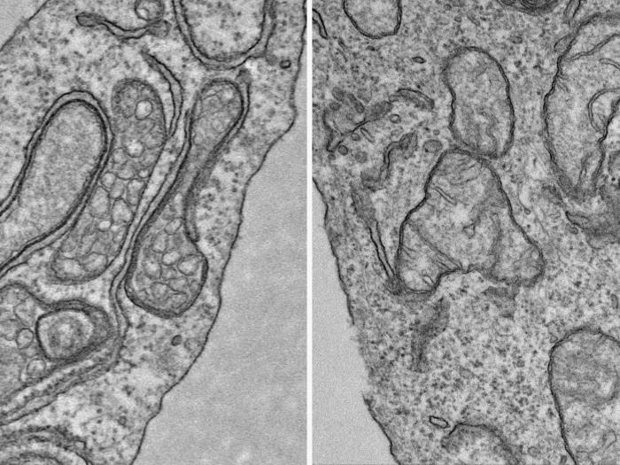 close up microscopic grey close up