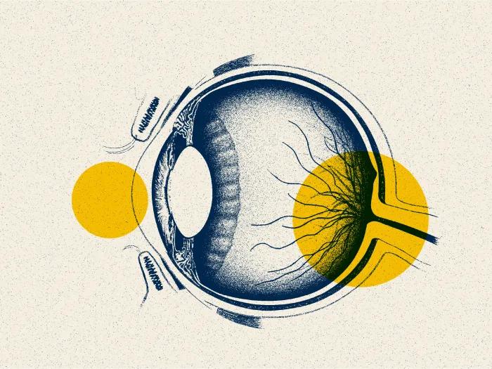 eye drawing yellow dots