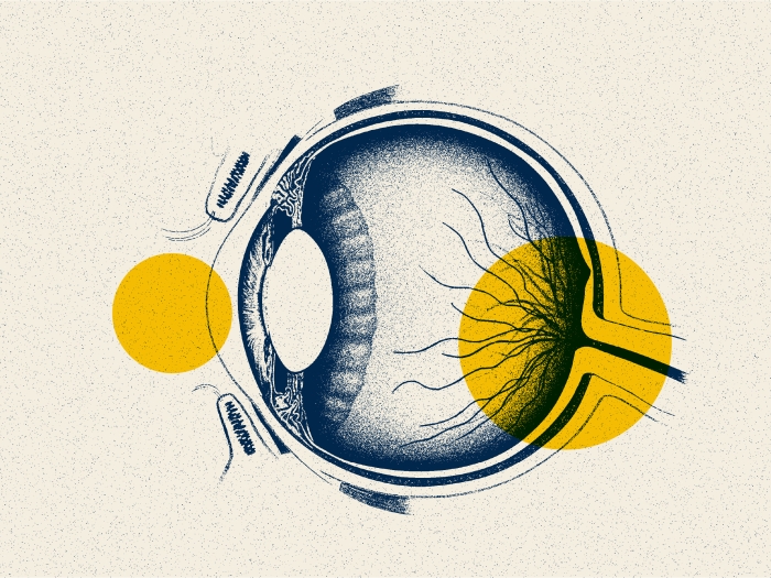 eye drawing yellow dots