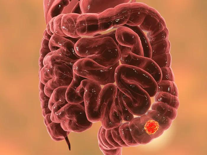 intestines red with red dot 