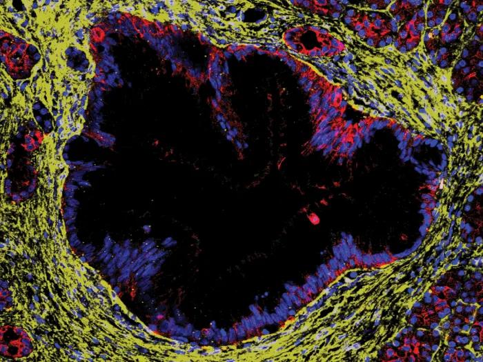 yellow black purple red cell in middle mostly black