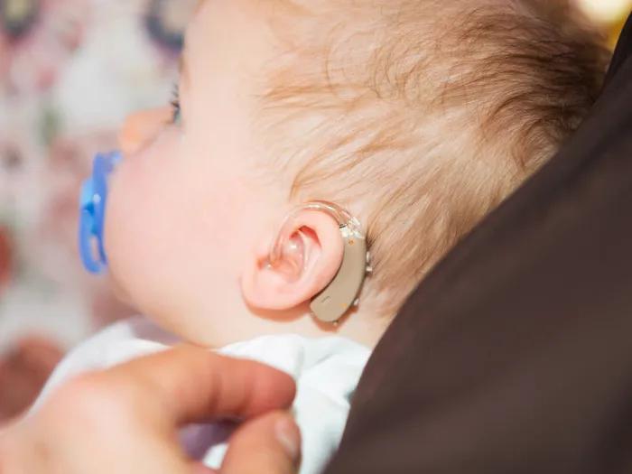 baby with hearing aid on ear looking from side view with blue pacifier in mouth