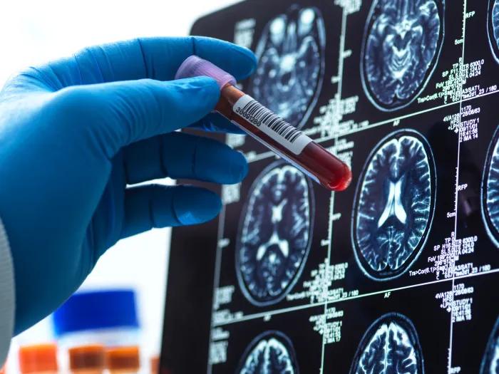 blood sample being checked against the medical scan during a clinical trial