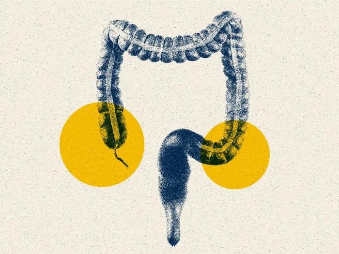 A graphic of a large intestine with two yellow circles