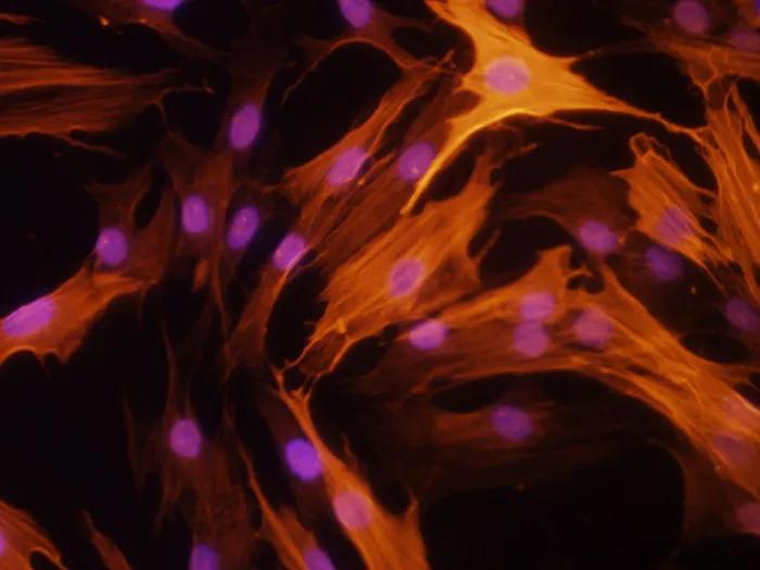 auto immune image