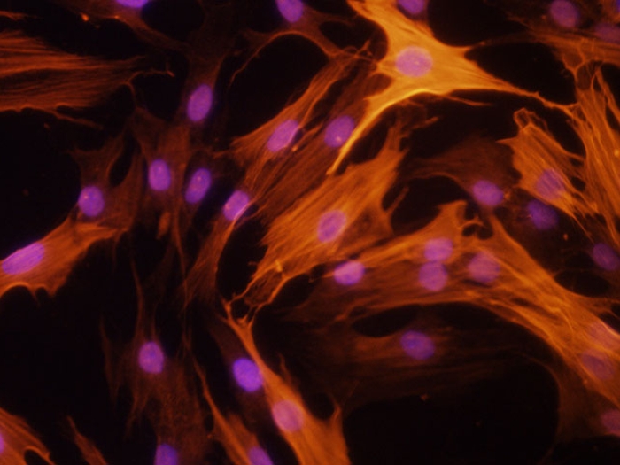 auto immune image
