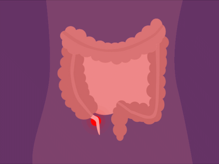 stomach with appendicitis flashing red