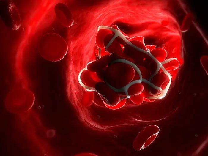 blood clot red cells