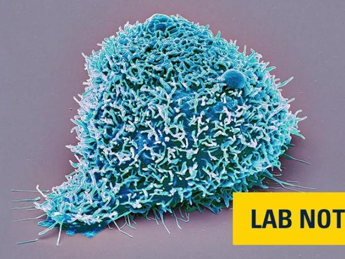 blue kidney cancer cell microscopic 