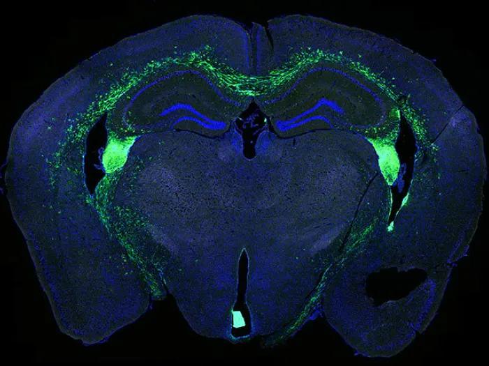 brain stem blue green slice