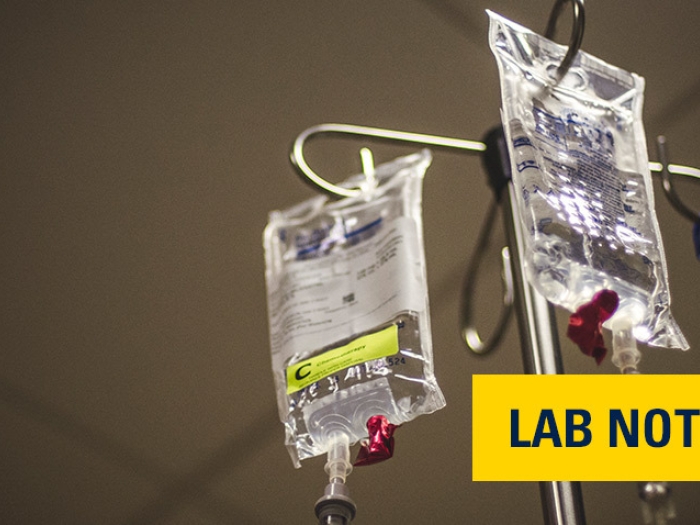 chemo medicine bags hanging on IV pole with lab note badge in yellow in background