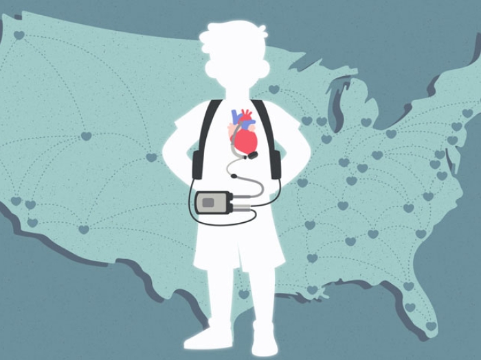 Child heart pump map behind of America in blue