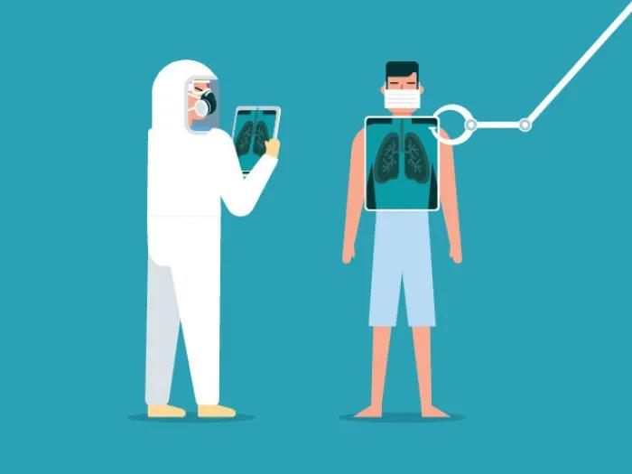 Coronavirus scanning lungs