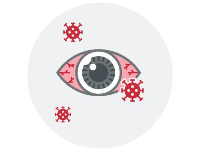 Covid with an eye
