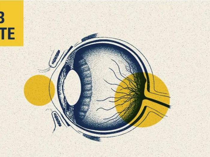 eye lab note