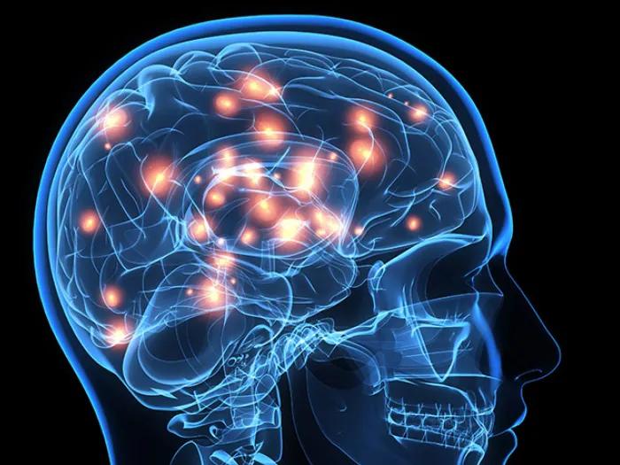 Brain 
