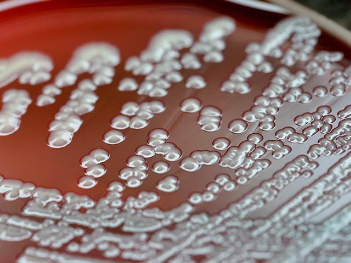 Petri dish
