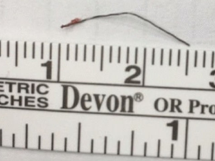 Ruler