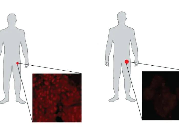 human silhouette groin zoom prostate 